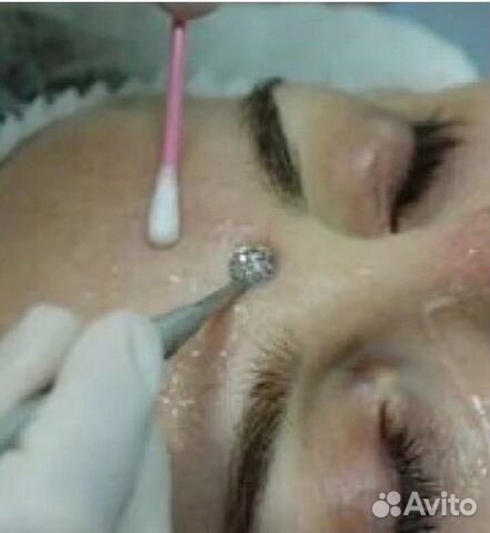 чистка механическая лица ложка. инструмент для чистки лица ложка уно. ложка для механической чистки.